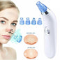 Blackhead Electric Pore Export Blackhead Cleaner - White