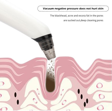 Blackhead suction instrument
