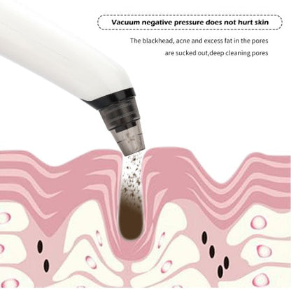 Blackhead suction instrument