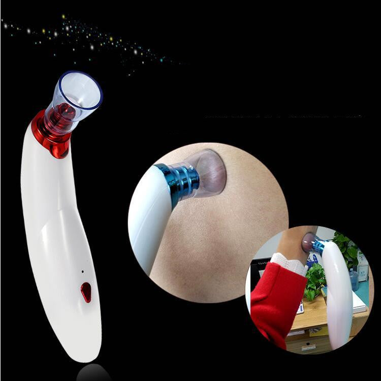 Electric Blackhead Suction Device To Remove Acne Horny Pores And Cleansing Multifunctional Cupping Cleaner - Red