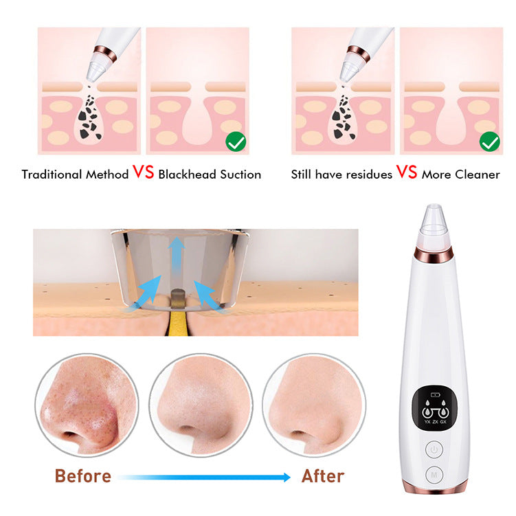 Facial instrument cleanser - White
