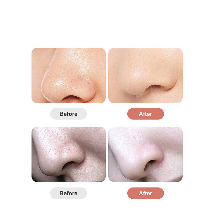 Household Pore Cleaner Electric Blackhead Absorber - White / USB